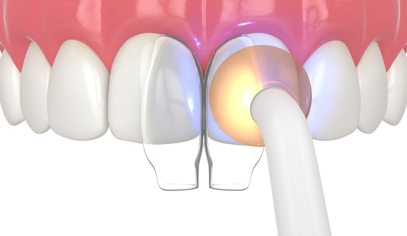 Berkhamsted Dental Practice