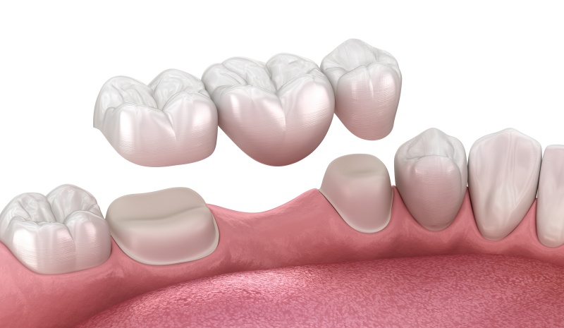 Berkhamsted Dental Practice